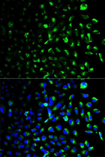 Immunofluorescence analysis of U2OS cells using HK1 Polyclonal Antibody