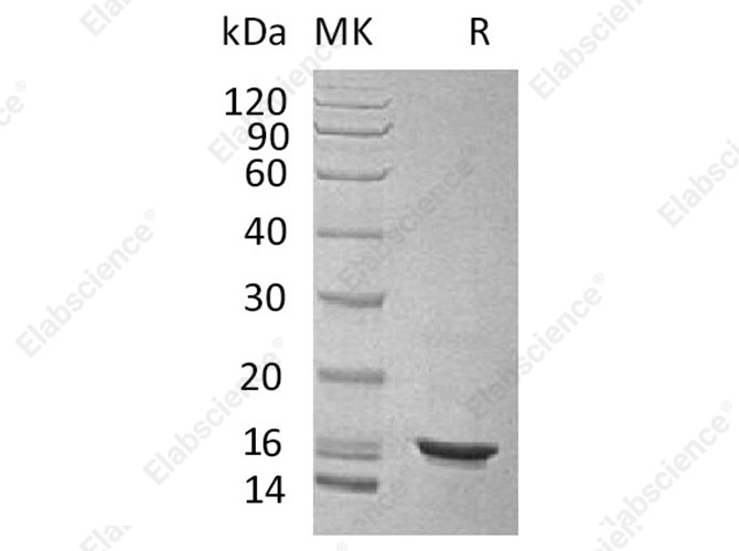 Recombinant Human IL-10/Interleukin-10 Protein - 1