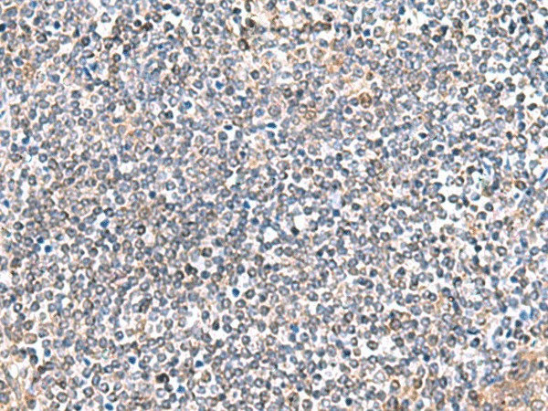 Immunohistochemistry of paraffin-embedded Human tonsil tissue  using ITGA3 Polyclonal Antibody at dilution of 1:45(?200)