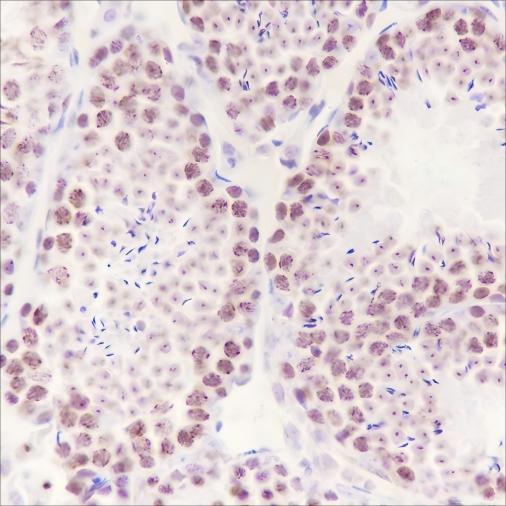 Recombinant HMGA1 Monoclonal Antibody-searchlist-1