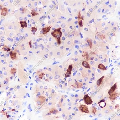 Recombinant FSH beta Monoclonal Antibody - 2