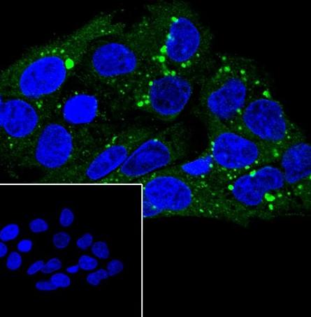 Recombinant Scavenging Receptor SR-BI Monoclonal Antibody - small - 6