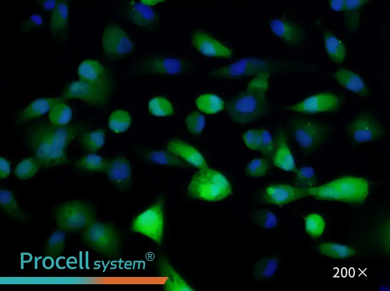 ACHN-GFP Cell Complete MediumACHN-GFP Cell Complete Medium - 3