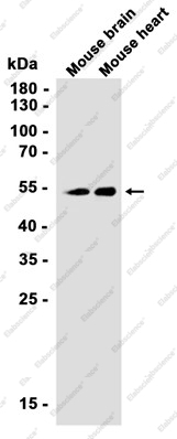 Recombinant Glucose Transporter GLUT3 Monoclonal Antibody - 1