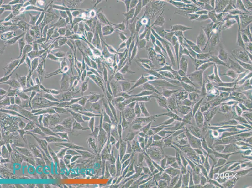 CCF-STTG1 Cell Complete Medium - 5