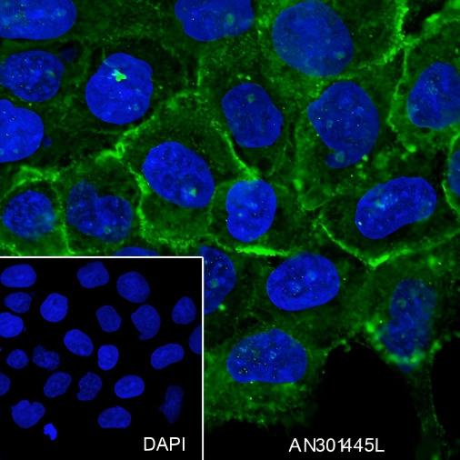 Recombinant beta-2 Adrenergic Receptor Monoclonal Antibody - 3