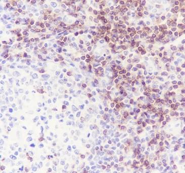 Recombinant CD3D Monoclonal Antibody - small - 3