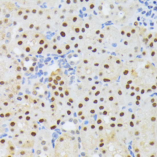 Immunohistochemistry of paraffin-embedded mouse kidney using ELAC2 Polyclonal antibody at dilution of 1:200 (40x lens).Perform microwave antigen retrieval with 10 mM PBS buffer pH 7.2 before commencing with IHC staining protocol.