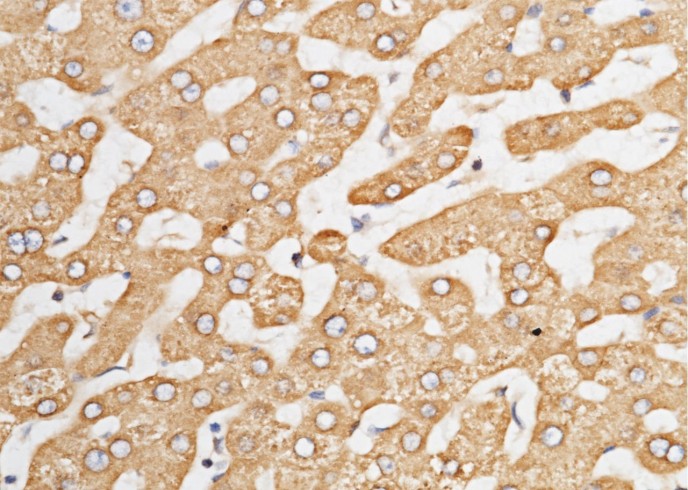 Recombinant ORP150/ORP150/HYOU1/HSP12A Monoclonal Antibody - small - 2