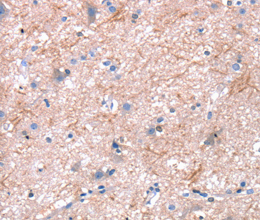 Immunohistochemistry of paraffin-embedded Human brain using Dap3 Polyclonal Antibody at dilution of 1:45