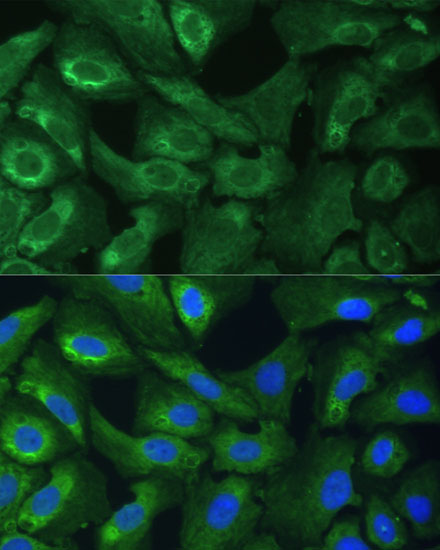 Immunofluorescence analysis of U-2 OS cells using EIF3G Polyclonal Antibody at dilution of  1:100 (40x lens). Blue: DAPI for nuclear staining.