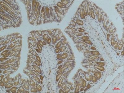 Immunohistochemistry of paraffin-embedded Mouse colon tissue using AMPK alpha1 Monoclonal Antibody at dilution of 1:200.