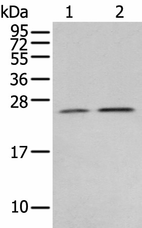 Western blot analysis of Human fetal brain tissue 231 cell  using RAB11A Polyclonal Antibody at dilution of 1:400