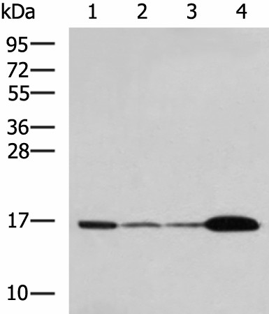 Western blot analysis of Mouse brain tissue Hela cell LNCAP cell HepG2 cell Jurkat cell lysates  using UBE2N Polyclonal Antibody at dilution of 1:800