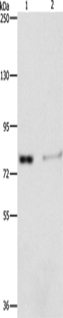 Western Blot analysis of Human fetal kidney tissue and 293T cell using ASAH2 Polyclonal Antibody at dilution of 1:240