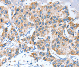 APOBEC3D Polyclonal Antibody - 2