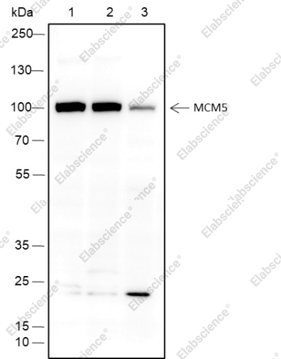 Recombinant MCM5 Monoclonal Antibody - 1