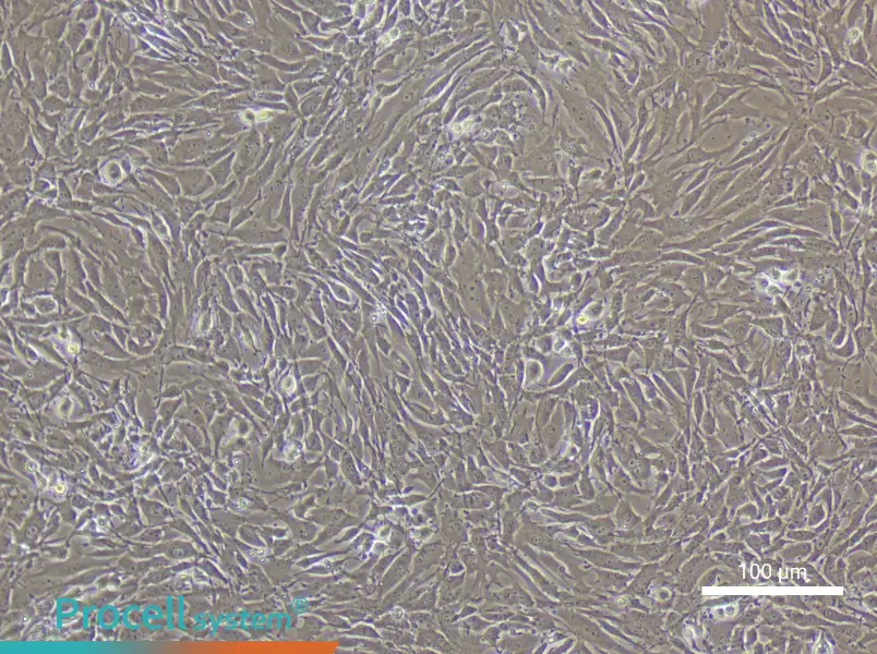Mouse Pulmonary Great Artery Smooth Muscle Cell Complete Medium - 1