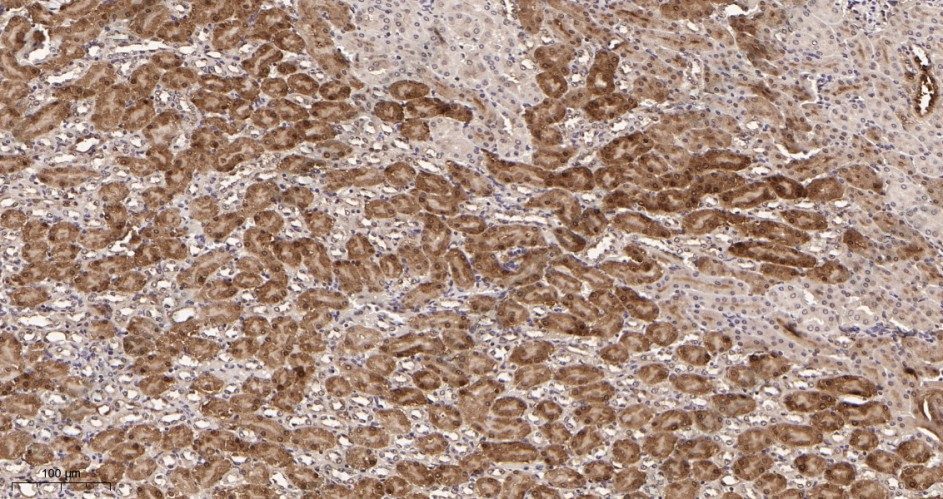 Recombinant NQO1 Monoclonal Antibody - 3