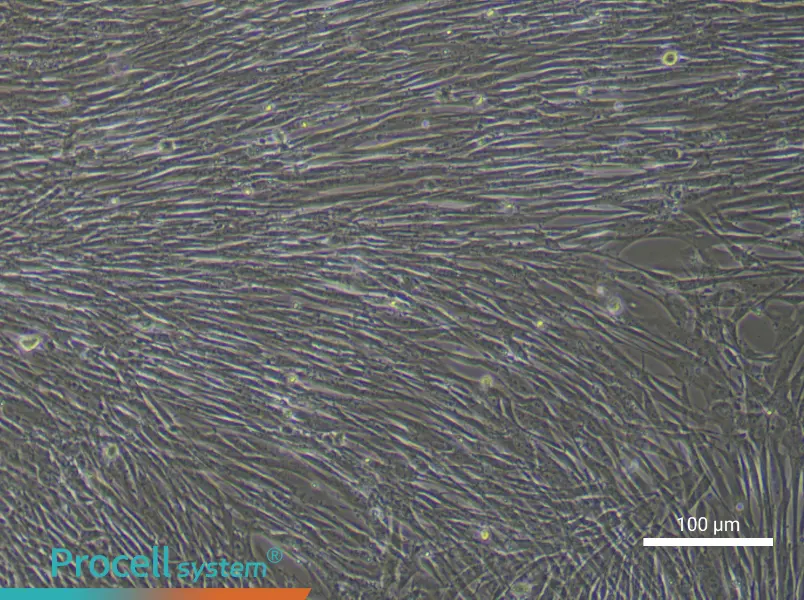 Human Lung Cancer‑Associated Fibroblast Complete Medium - 3