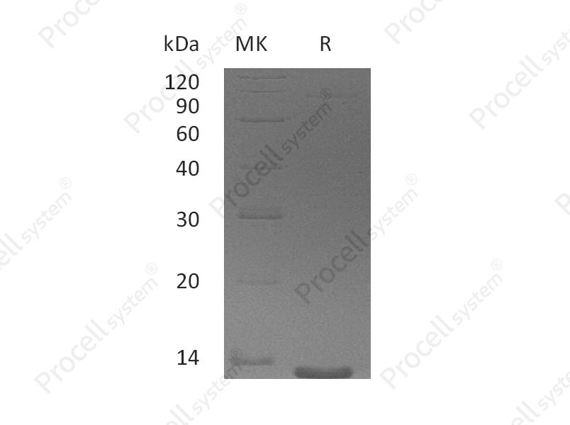 Eotaxin-3/CCL26 (24-94), Human, Recombinant