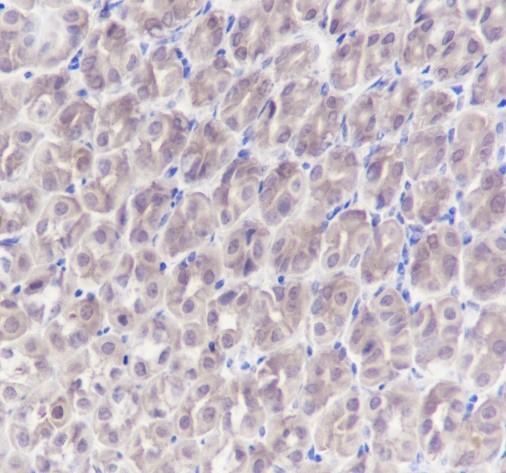 Recombinant GST3/GSTP1 Monoclonal Antibody - 3