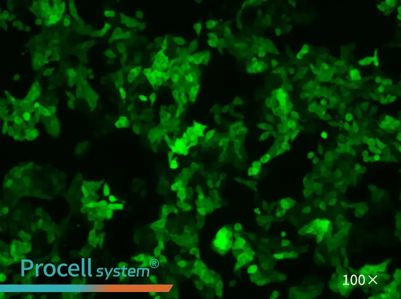 SW620-GFP Cell Complete Medium - 1