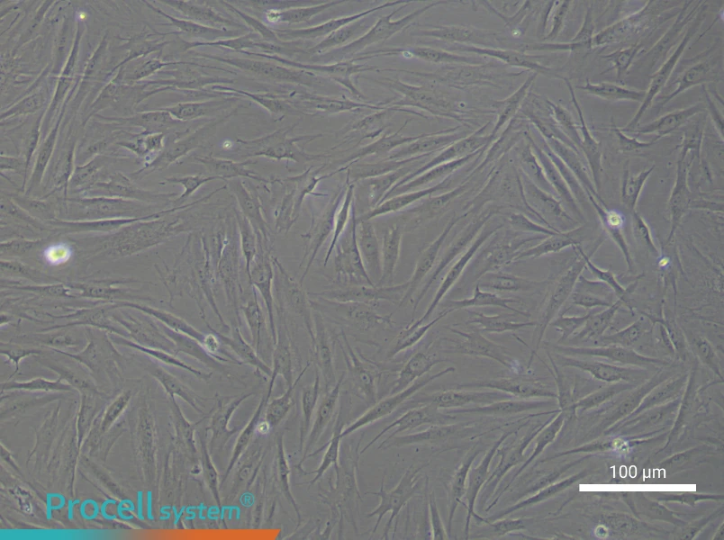 Human Aortic Adventitial Fibroblast Complete Medium - 2