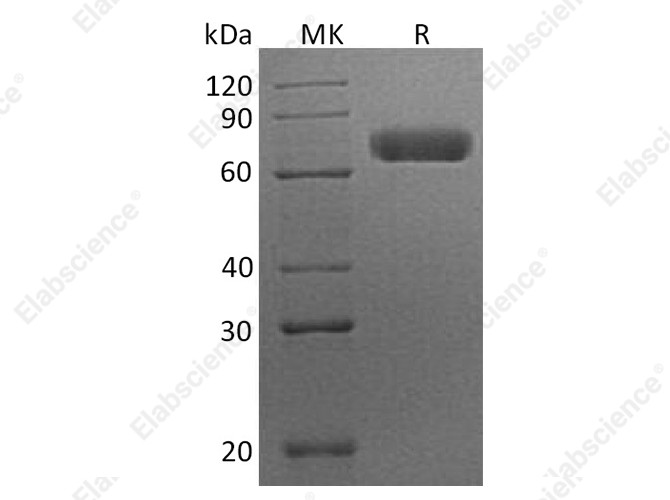 Recombinant Human EphA7/EHK3 Protein (His Tag) - 1