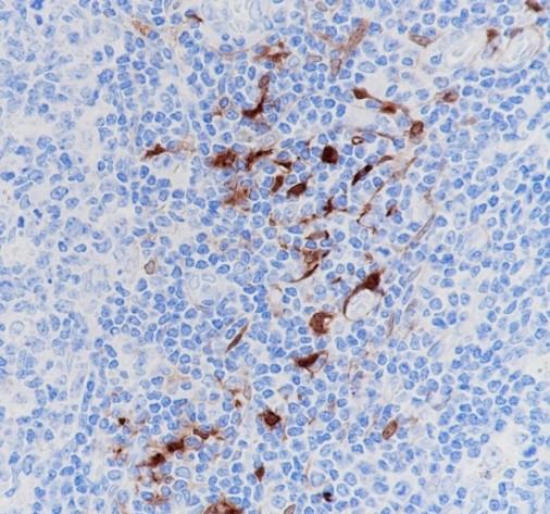 Recombinant IDO1 Monoclonal Antibody - 3