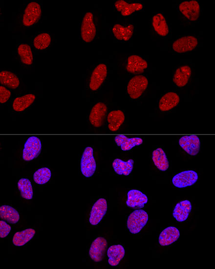 Confocal immunofluorescence analysis of U-2 OS cells using METTL3 Polyclonal Antibody at dilution of  1:200. Blue: DAPI for nuclear staining.