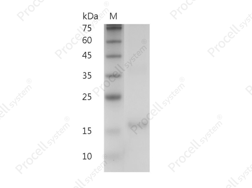 IL-7/LP-1, Human, Recombinant