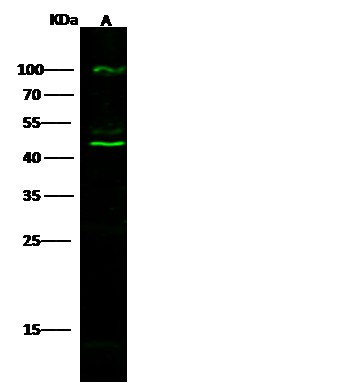 Recombinant Cathepsin D/CTSD Monoclonal Antibody - small - 2