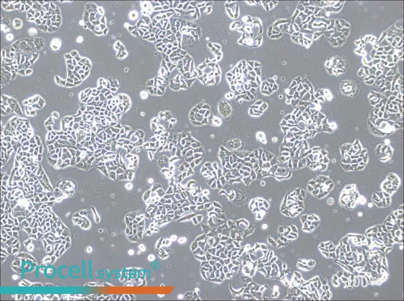 HCC1833 Cell Complete Medium - 1