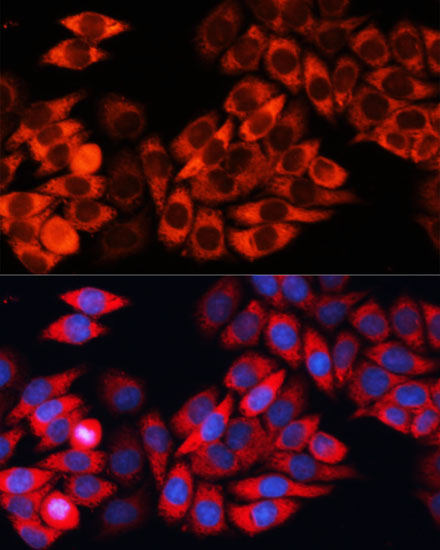 Immunofluorescence analysis of HeLa cells using eIF3B Polyclonal Antibody at dilution of 1:100 (40x lens). Blue: DAPI for nuclear staining.