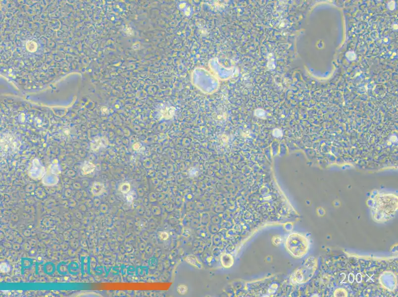 NCI-N87 [N87] Cell Complete Medium - small - 5