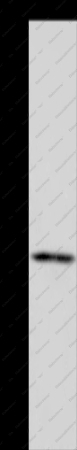 FTO Polyclonal Antibody - 1