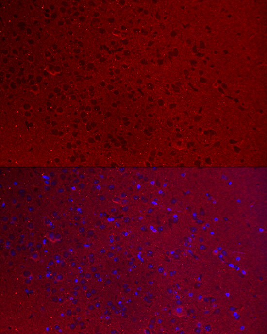 Immunofluorescence analysis of mouse brain cells using GNAO1 Polyclonal Antibody at dilution of 1:100 (40x lens). Blue: DAPI for nuclear staining.