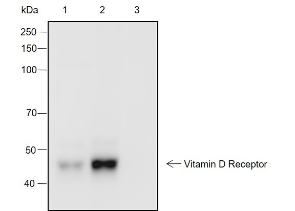 Recombinant Vitamin D Receptor Monoclonal Antibody - 3