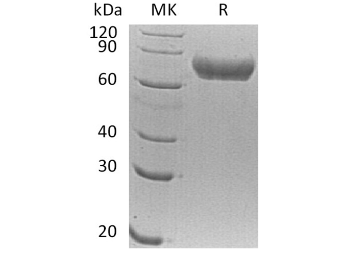 Recombinant Human FLRT1 Protein (His Tag)