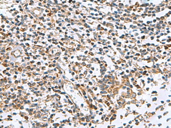 AP1S3 Polyclonal Antibody - small - 2
