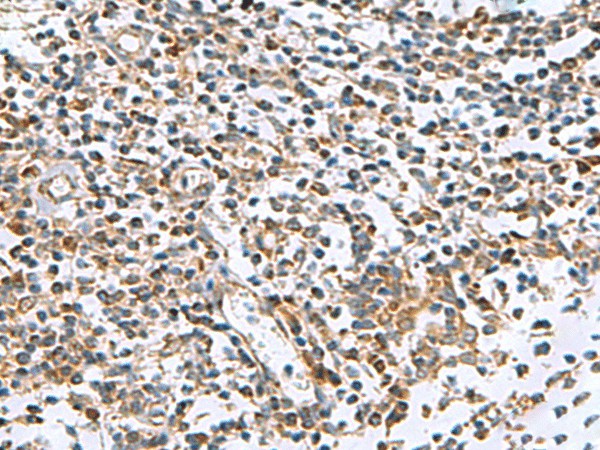 Immunohistochemistry of paraffin-embedded Human tonsil tissue  using AP1S3 Polyclonal Antibody at dilution of 1:55(?200)