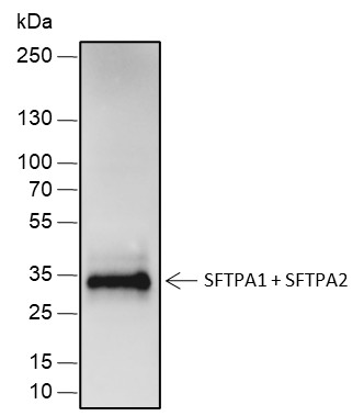 Recombinant SFTPA1+SFTPA2 Monoclonal Antibody - 2