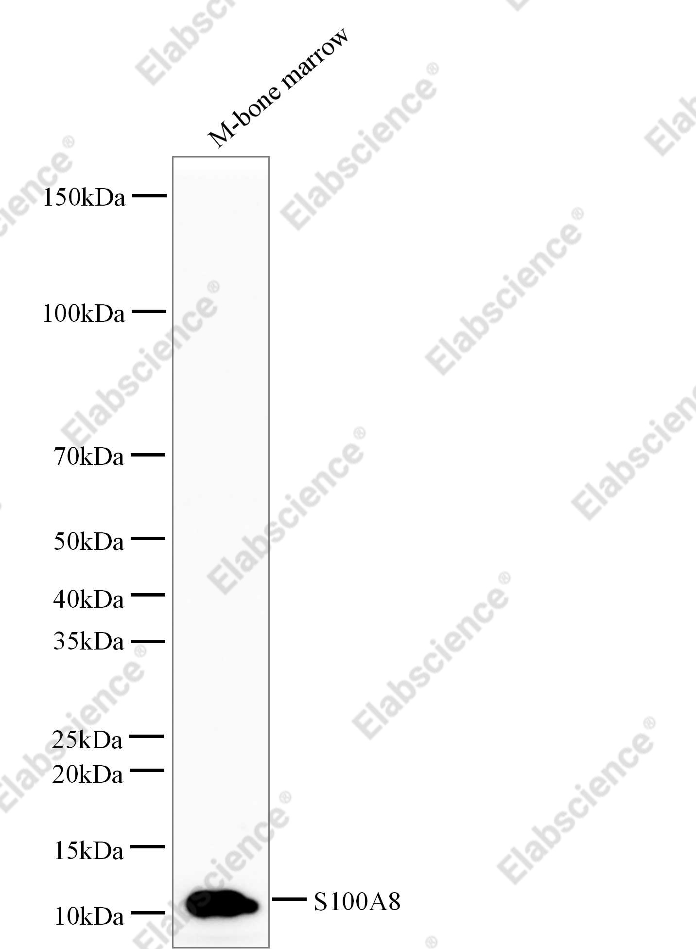 Recombinant S100A8 Monoclonal Antibody - 1