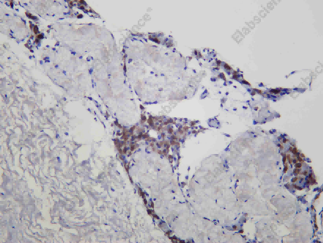 Recombinant FDX1 Monoclonal Antibody - 1