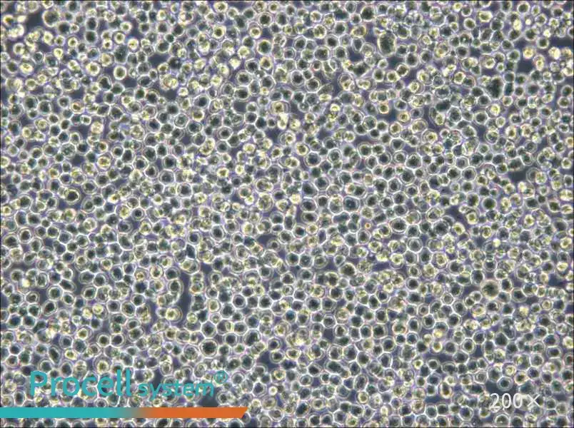 NB4 Cell Complete Medium - small - 6