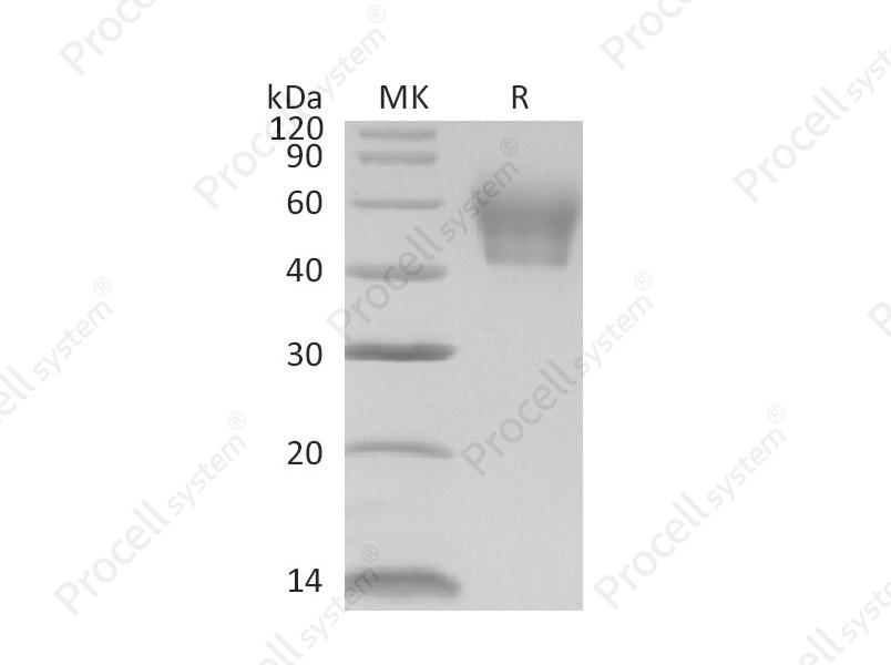IL-1R-2/CD121b (C-6His), Mouse, Recombinant