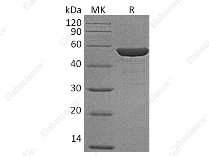 Recombinant Human NSE/ENO2 Protein (His Tag) - 1