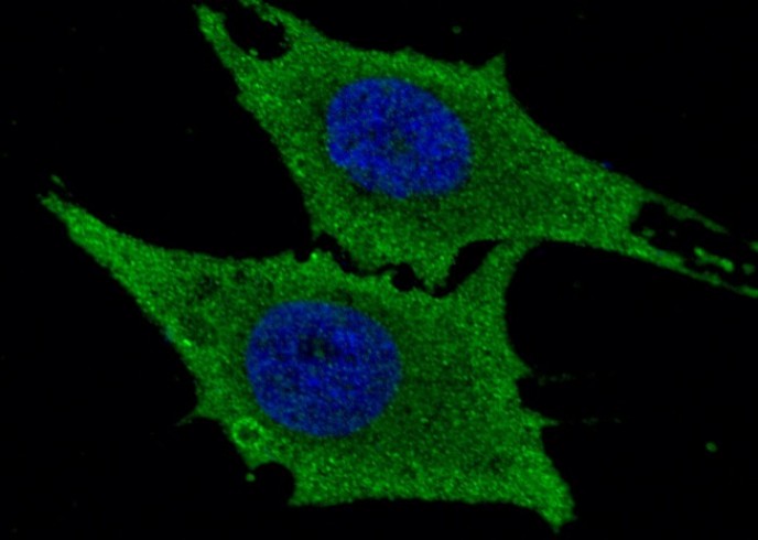 Recombinant Leukotriene A4 Hydrolase/LTA4H Monoclonal Antibody - small - 1