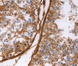 Caldesmon Polyclonal Antibody - 2